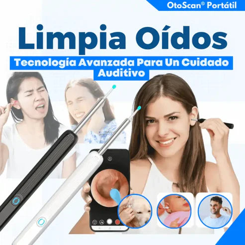 OtoCam – Limpiador de Oídos con Cámara HD