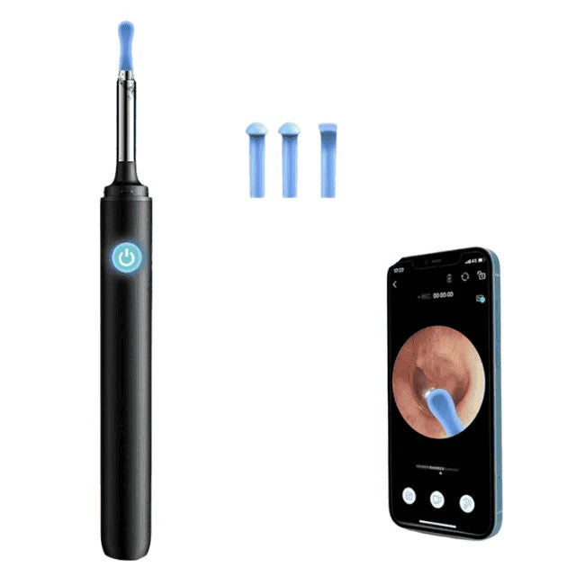 OtoCam – Limpiador de Oídos con Cámara HD